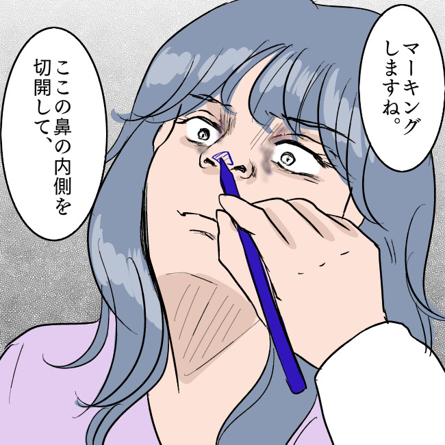 撚(よ)れし造花〜整形失敗女〜Vol.10 │ 徒然漫画 毒のある人々